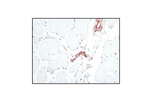 Immunohistochemistry Image 1: PKM2 (D78A4) XP<sup>®</sup> Rabbit mAb (BSA and Azide Free)