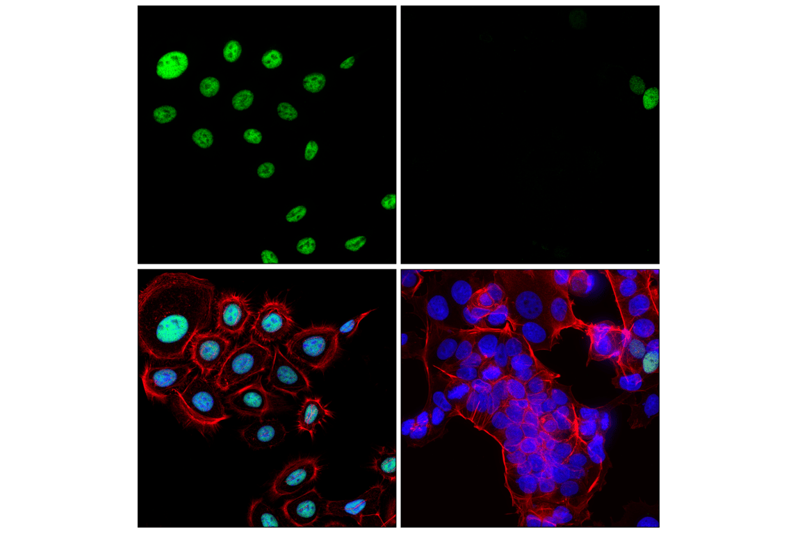 Immunofluorescence Image 1: p63-alpha (D2K8X) Rabbit Monoclonal Antibody