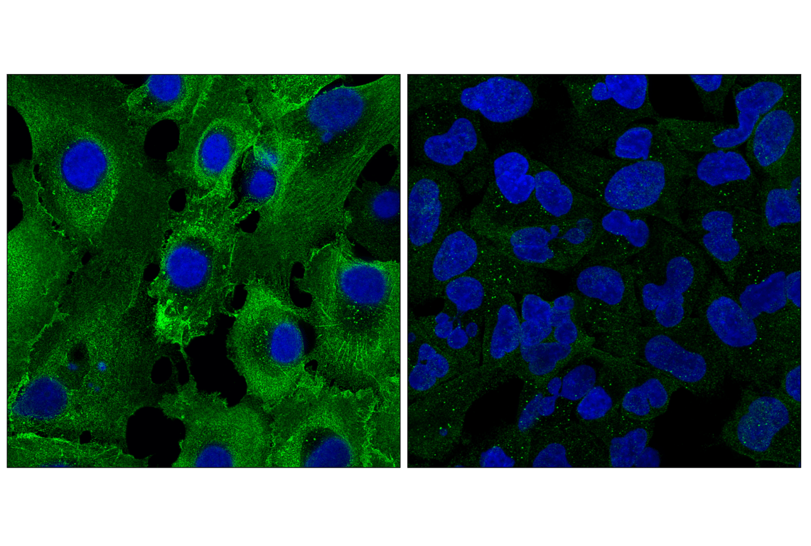 Immunofluorescence Image 1: TMOD3 (F9M4D) Rabbit Monoclonal Antibody