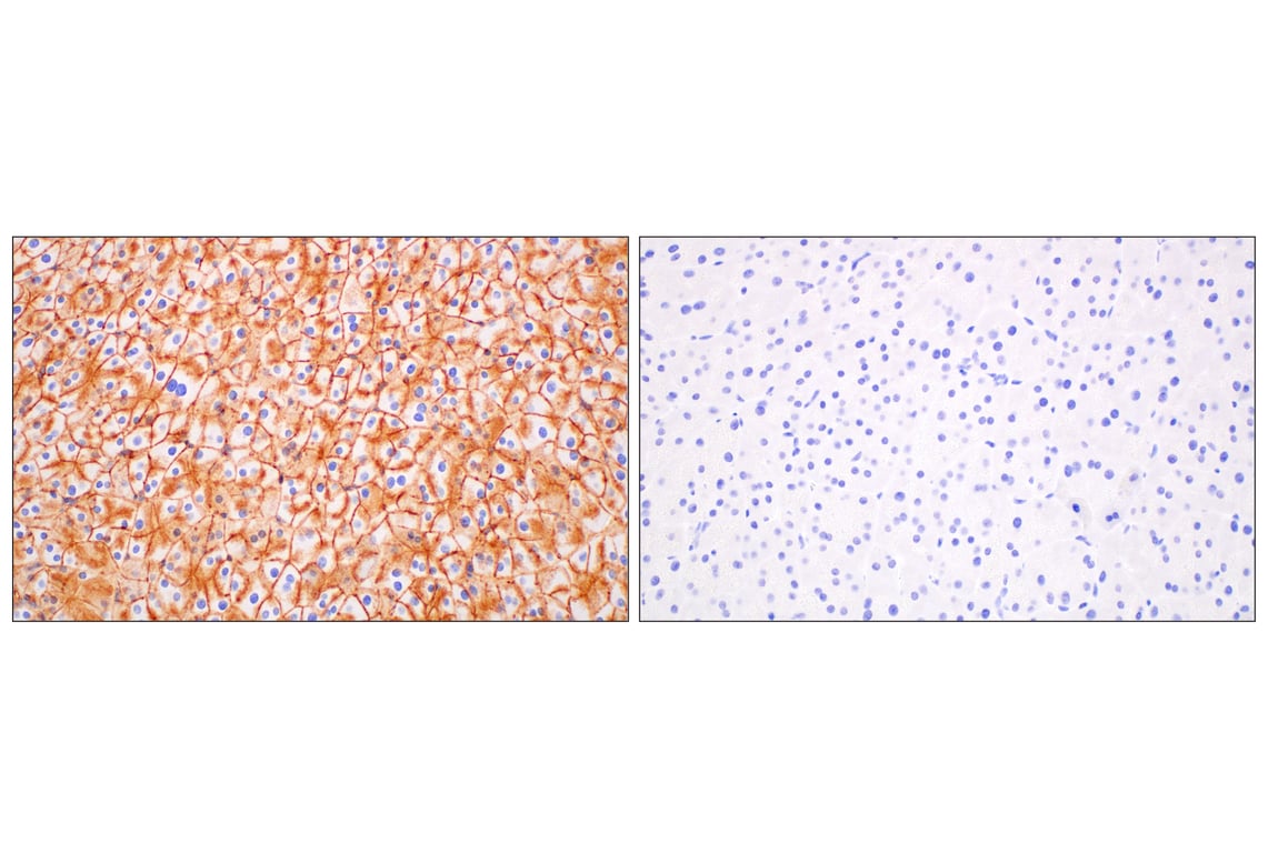 Immunohistochemistry Image 8: CD47 (E2V9V) Rabbit Monoclonal Antibody (BSA and Azide Free)