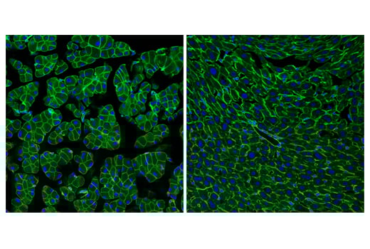 Immunofluorescence Image 1: Ras (E4K9L) Rabbit Monoclonal Antibody (BSA and Azide Free)