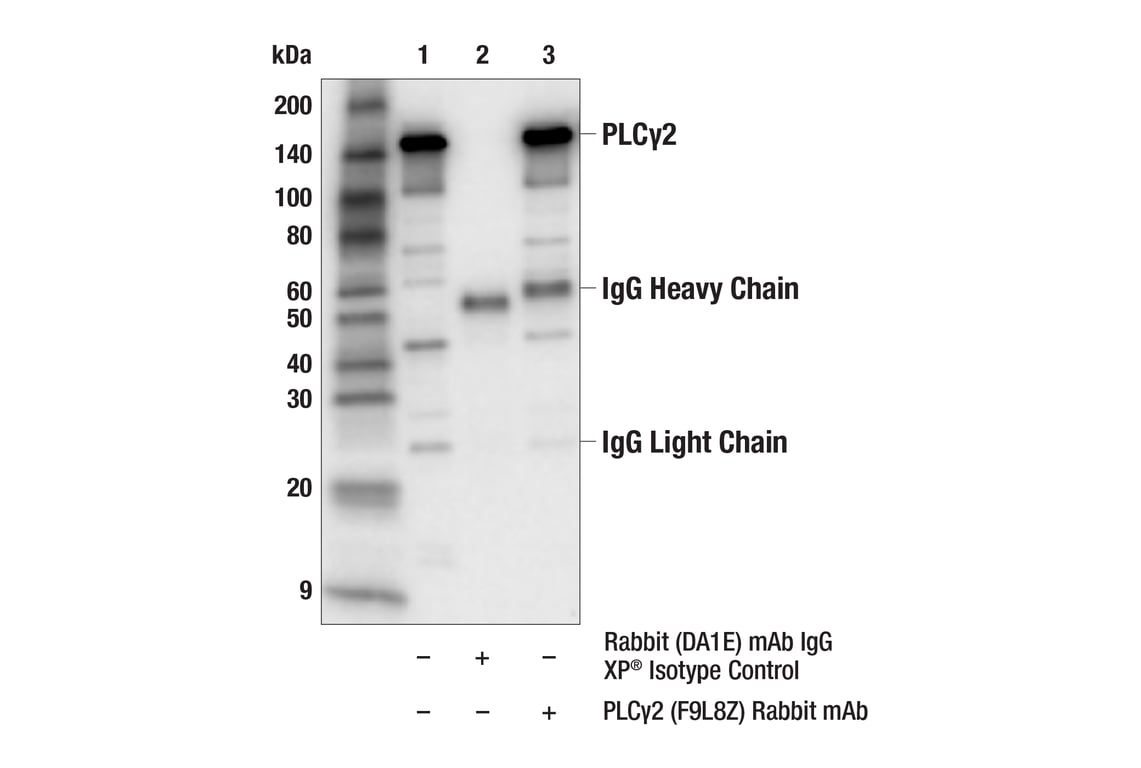 Immunoprecipitation Image 1: PLC gamma2 (F9L8Z) Rabbit Monoclonal Antibody