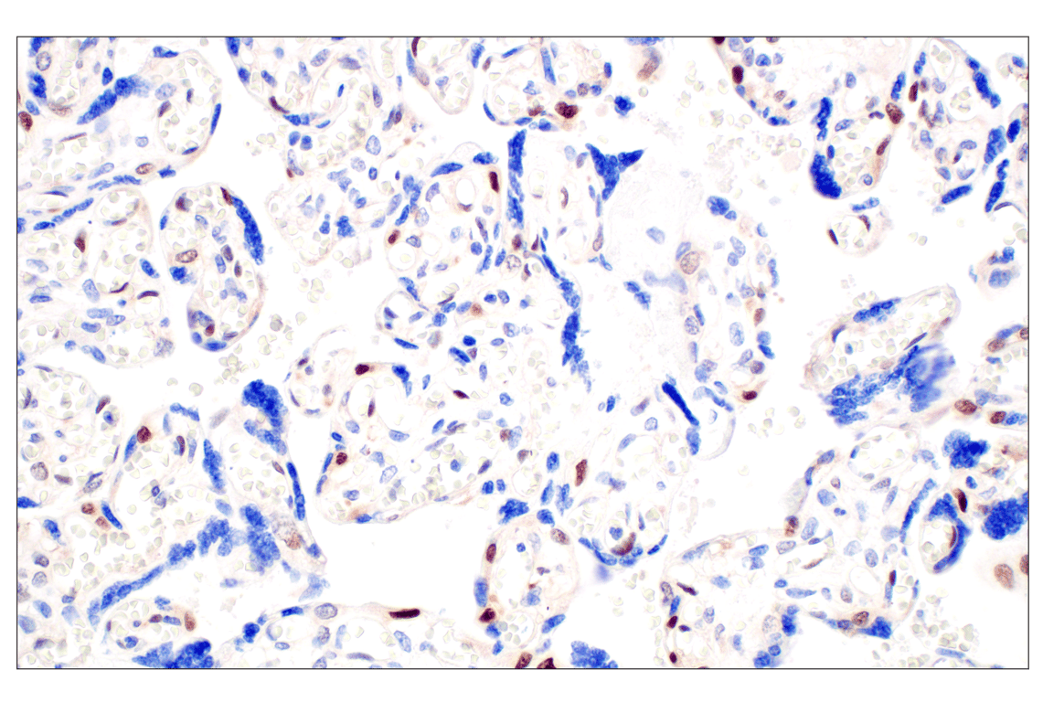 Immunohistochemistry Image 5: CDK6 (E3E3Q) Rabbit Monoclonal Antibody (BSA and Azide Free)