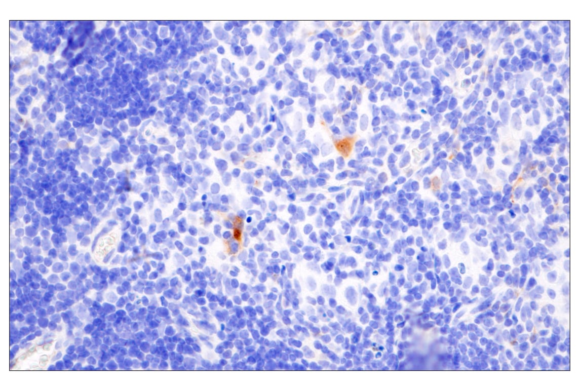 Immunohistochemistry Image 5: Cathepsin K (E7U5N) Rabbit Monoclonal Antibody
