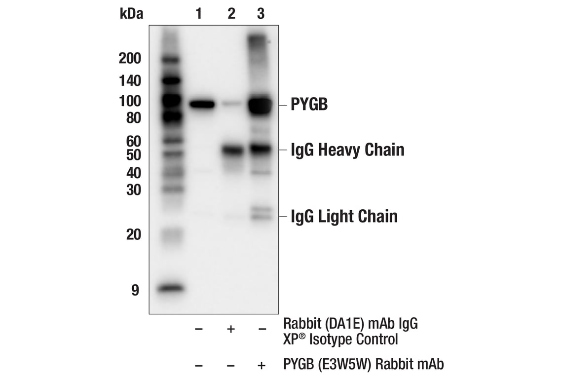 Immunoprecipitation Image 1: PYGB (E3W5W) Rabbit Monoclonal Antibody