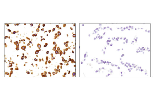 undefined Image 37: Lung Cancer RTK Antibody Sampler Kit