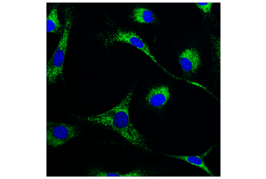 Immunofluorescence Image 1: Cathepsin D (E7Z4L) Rabbit Monoclonal Antibody (BSA and Azide Free)