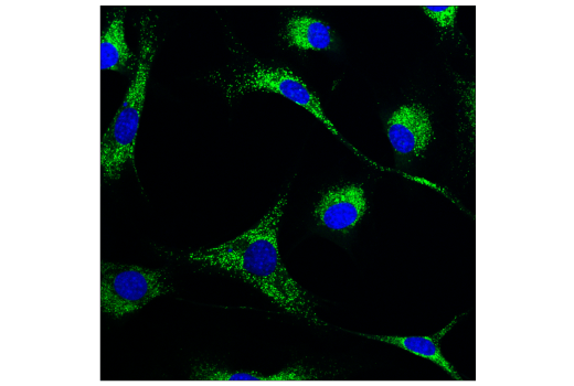 Immunofluorescence Image 1: Cathepsin D (E7Z4L) XP<sup>®</sup> Rabbit mAb (BSA and Azide Free)