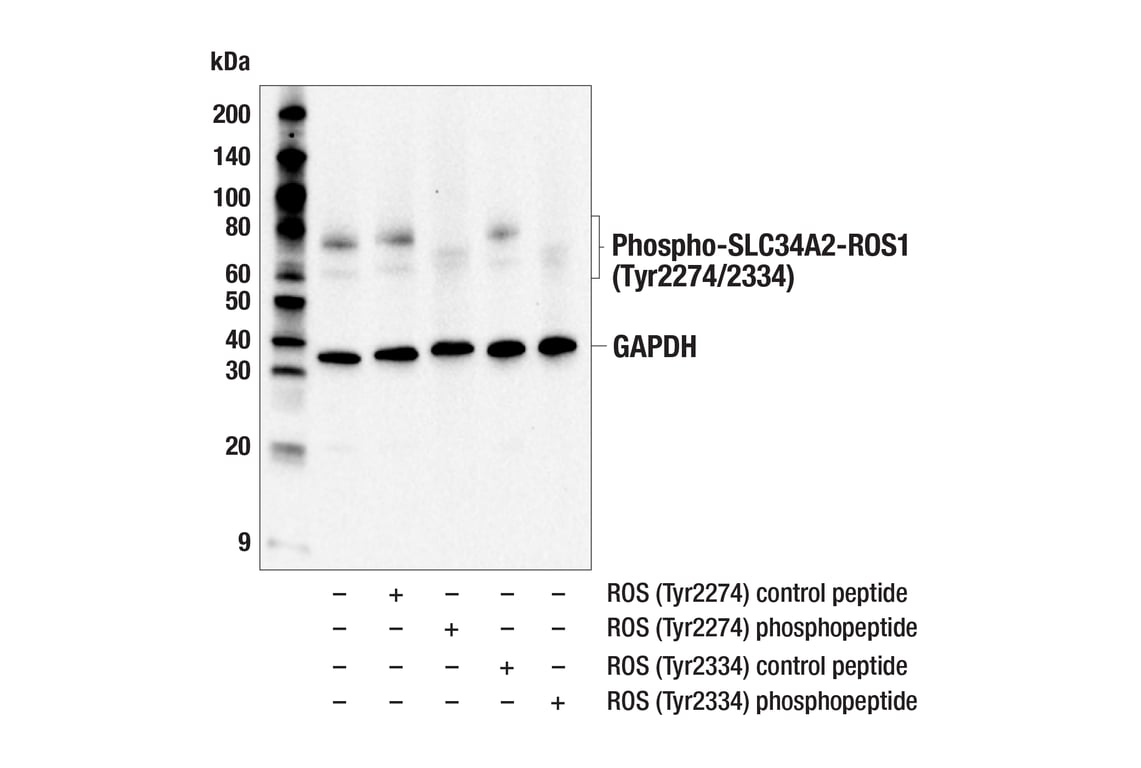 Western Blotting Image 3: Phospho-ROS1 (Tyr2274/2334) (E8F5J) Rabbit Monoclonal Antibody