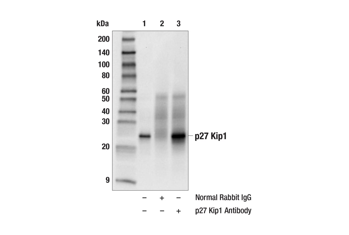 Immunoprecipitation Image 1: p27 Kip1 Antibody