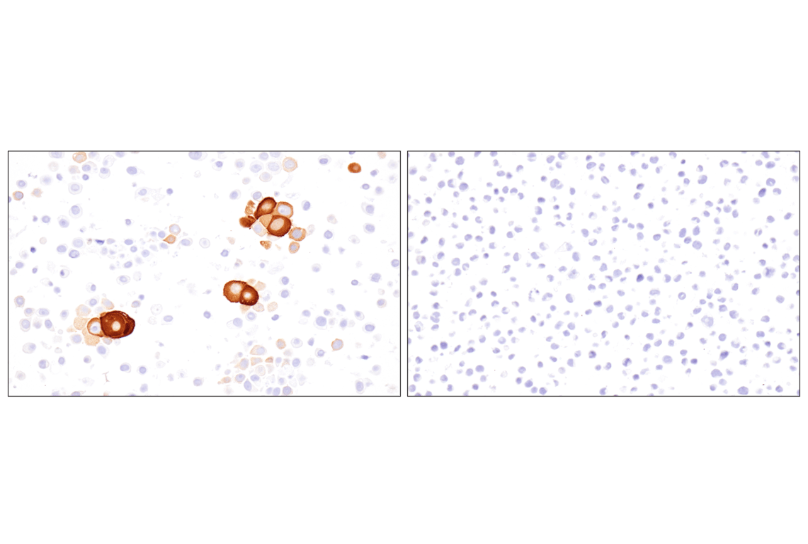 Immunohistochemistry Image 10: Involucrin (F9C3C) Rabbit Monoclonal Antibody