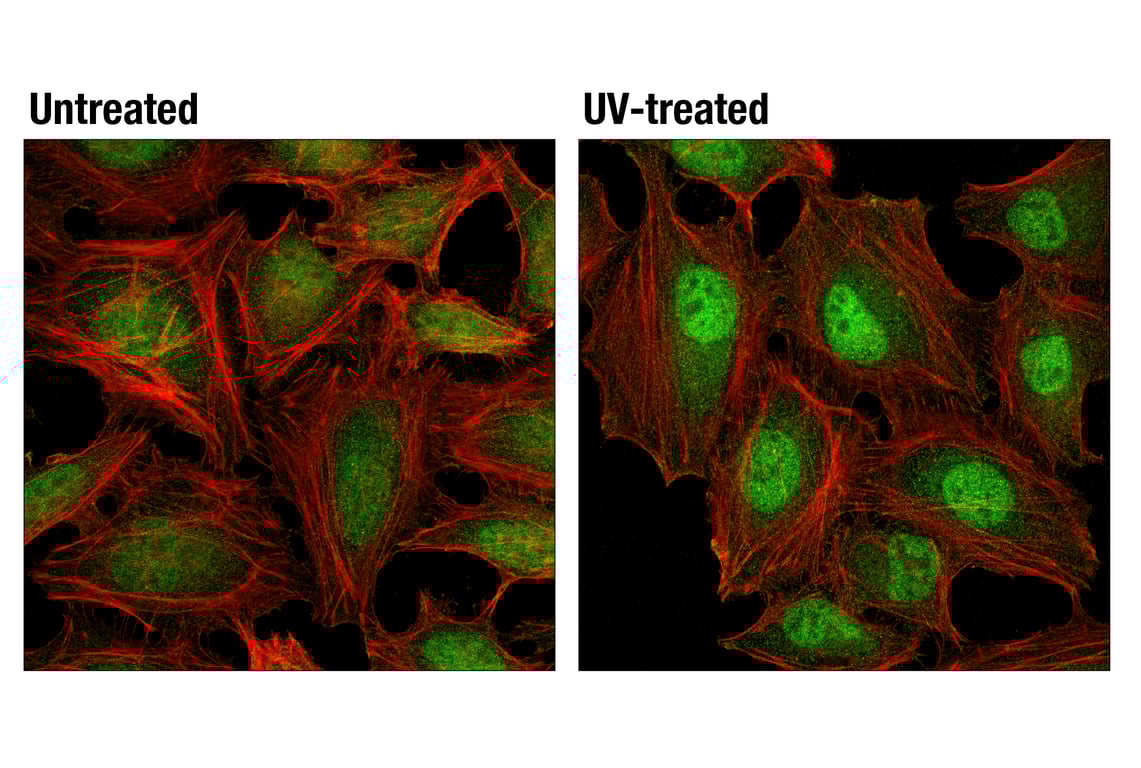 Immunofluorescence Image 1: p38 MAPK (D13E1) Rabbit Monoclonal Antibody (BSA and Azide Free)