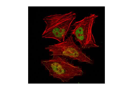 Immunofluorescence Image 1: GCN5L2 (C26A10) Rabbit Monoclonal Antibody