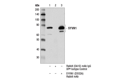Immunoprecipitation Image 1: SYVN1 (D3O2A) Rabbit Monoclonal Antibody