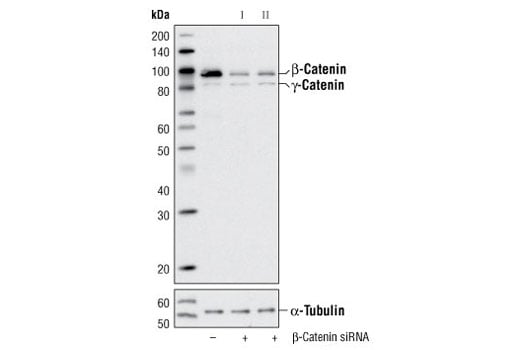 undefined Image 2: SignalSilence<sup>®</sup> beta-Catenin siRNA I