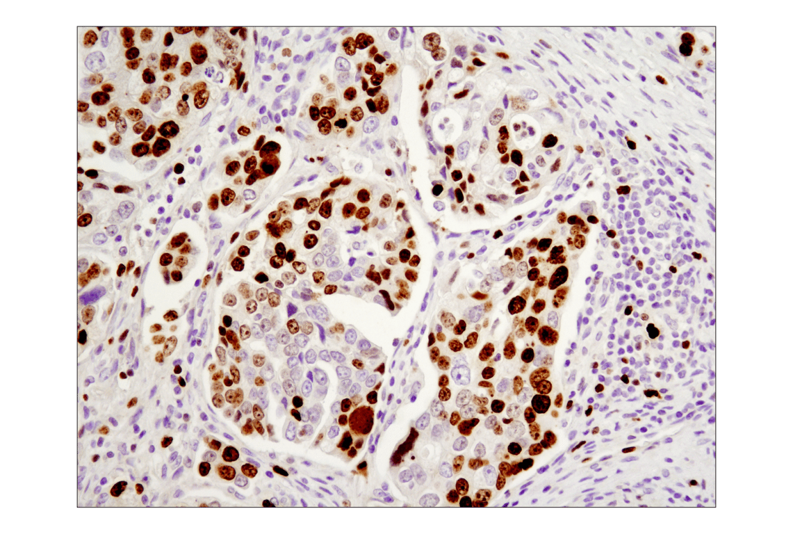 Immunohistochemistry Image 3: Ki-67 (8D5) Mouse Monoclonal Antibody (BSA and Azide Free)