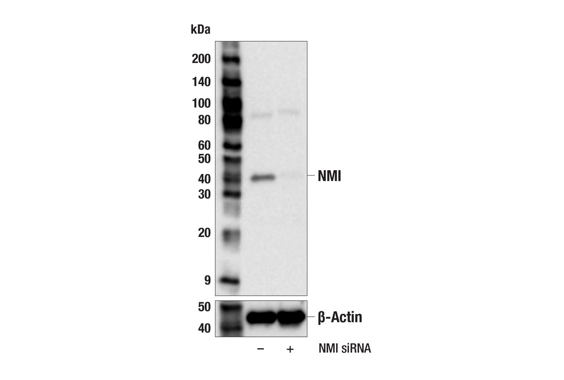 Western Blotting Image 2: NMI (F6F5E) Rabbit Monoclonal Antibody
