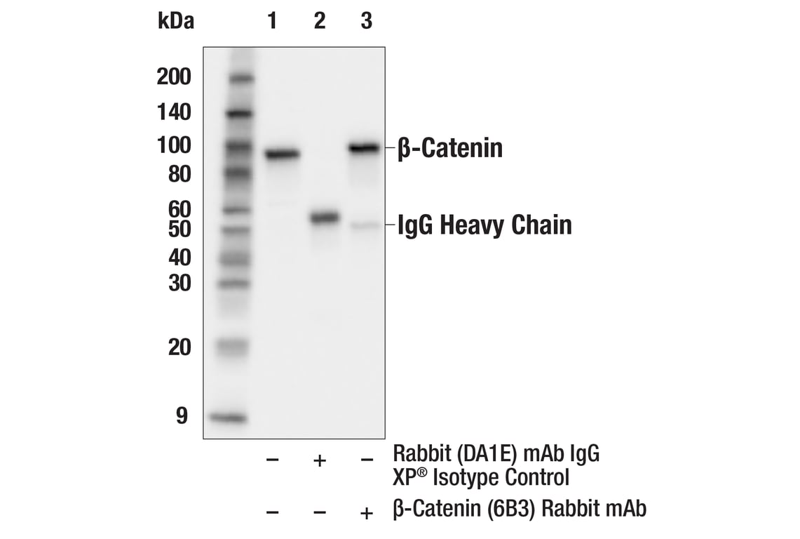 Immunoprecipitation Image 1: beta-Catenin (6B3) Rabbit Monoclonal Antibody