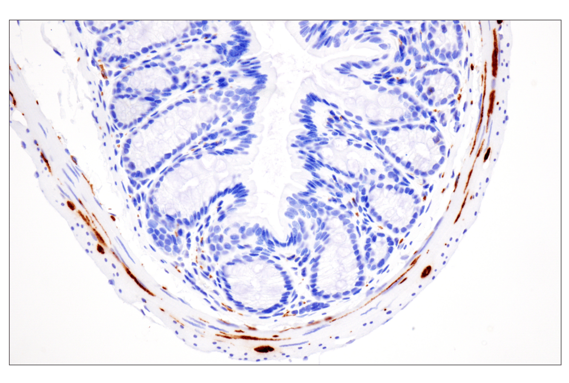 Immunohistochemistry Image 12: Phospho-Tau (Ser396) (F3S9T) Rabbit Monoclonal Antibody
