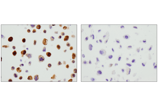Immunohistochemistry Image 4: GLUL (D2O3F) Rabbit Monoclonal Antibody (IHC Formulated)