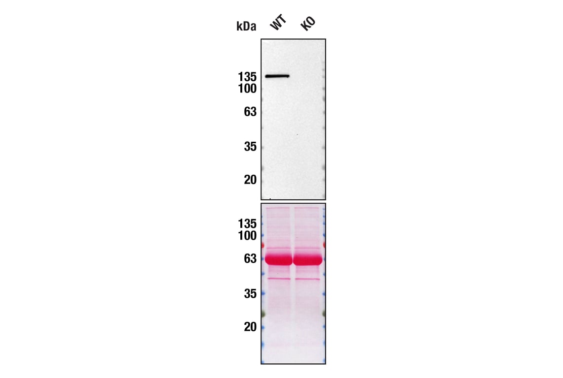 Western Blotting Image 2: SHIP1 (C15C9) Rabbit Monoclonal Antibody
