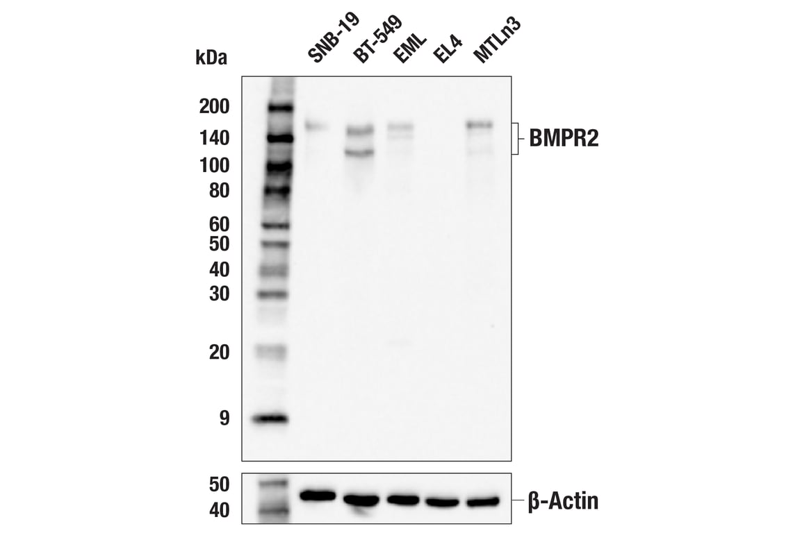 Western Blotting Image 2: BMPR2 (E9U5C) Rabbit Monoclonal Antibody
