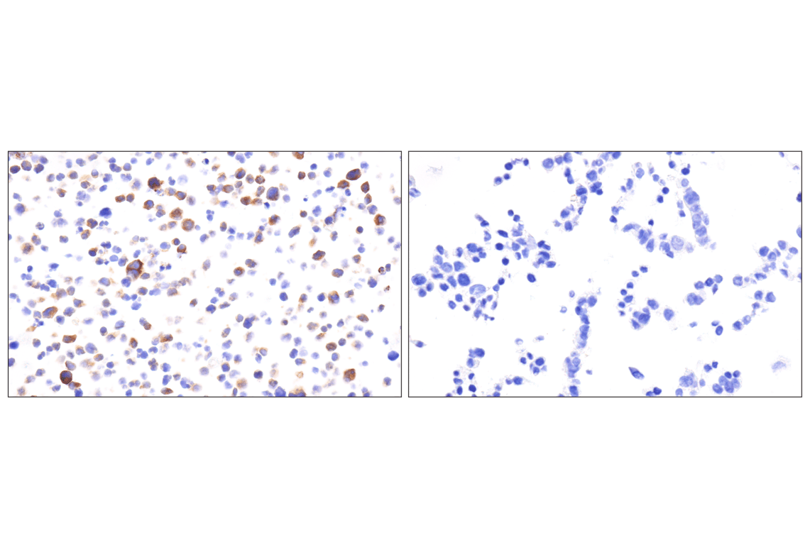 Immunohistochemistry Image 16: MYH11 (E4N8M) Rabbit Monoclonal Antibody (BSA and Azide Free)