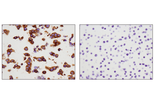 Immunohistochemistry Image 1: c-Kit (D3W6Y) Rabbit Monoclonal Antibody