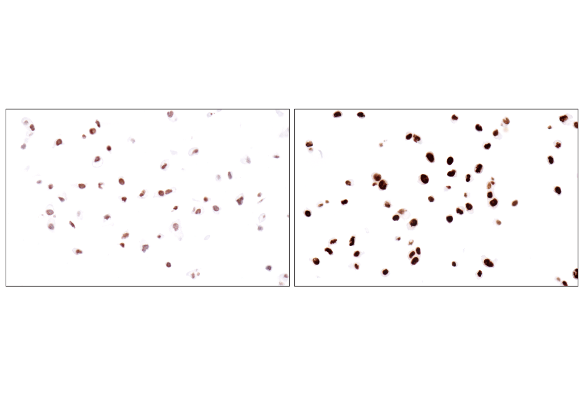 Immunohistochemistry Image 14: Acetyl-Histone H4 (Lys16) (E2B8W) Rabbit Monoclonal Antibody (BSA and Azide Free)