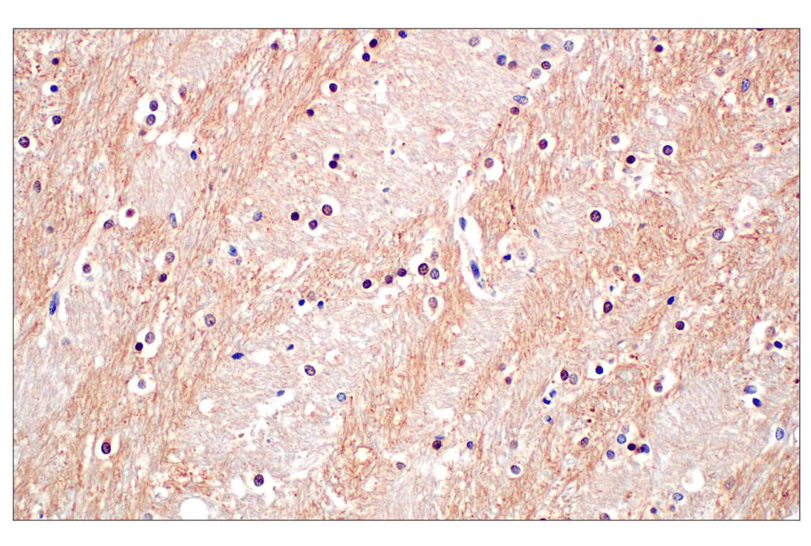 Immunohistochemistry Image 2: Phospho-Tau (Ser202) (F2A2F) Rabbit Monoclonal Antibody