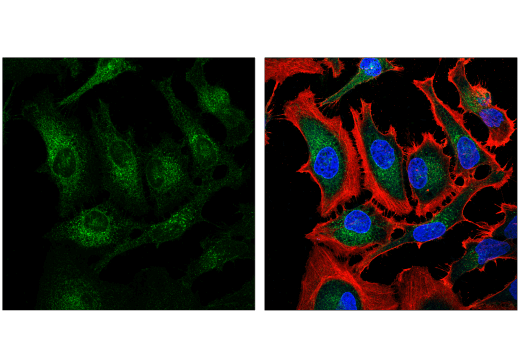 Immunofluorescence Image 1: Nicastrin (D4F6N) Rabbit Monoclonal Antibody