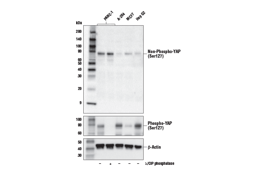 Western Blotting Image 1: Non-phospho (Active) YAP (Ser127) (E6U8Z) Rabbit mAb