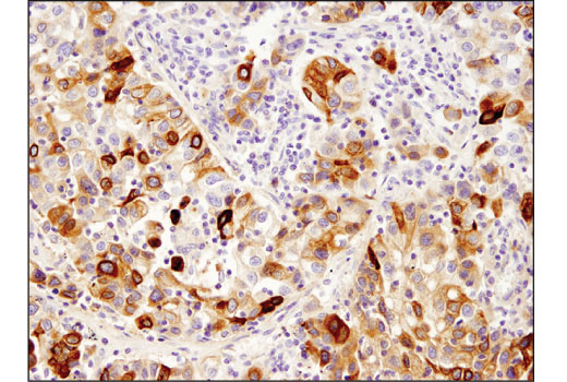 Immunohistochemistry Image 1: TFF1/pS2 (D2Y1J) Rabbit Monoclonal Antibody (BSA and Azide Free)
