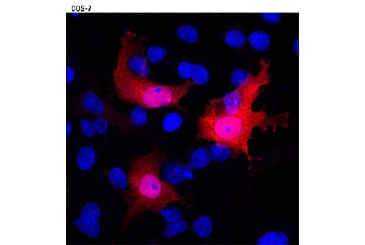 Immunofluorescence Image 1: GST (26H1) Mouse Monoclonal Antibody (Alexa Fluor<sup>®</sup> 594 Conjugate)
