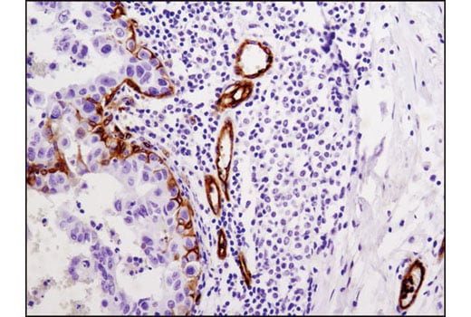 Immunohistochemistry Image 3: Integrin beta3 (D7X3P) Rabbit Monoclonal Antibody (BSA and Azide Free)