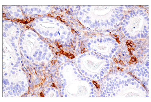 Immunohistochemistry Image 4: CD99 (PCB1) Mouse Monoclonal Antibody