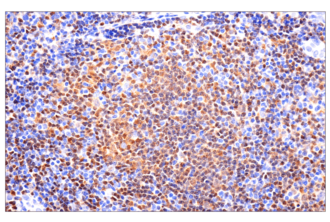 Immunohistochemistry Image 2: p47phox (F3Y6C) Rabbit Monoclonal Antibody