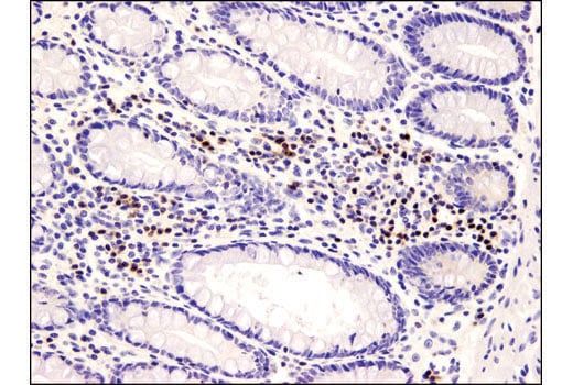Immunohistochemistry Image 1: PKC theta (E1I7Y) Rabbit Monoclonal Antibody
