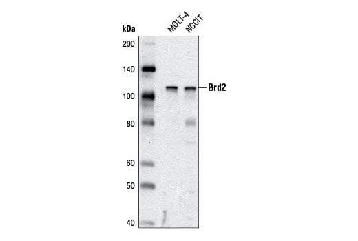 Western Blotting Image 1: Brd2 (D89B4) Rabbit mAb