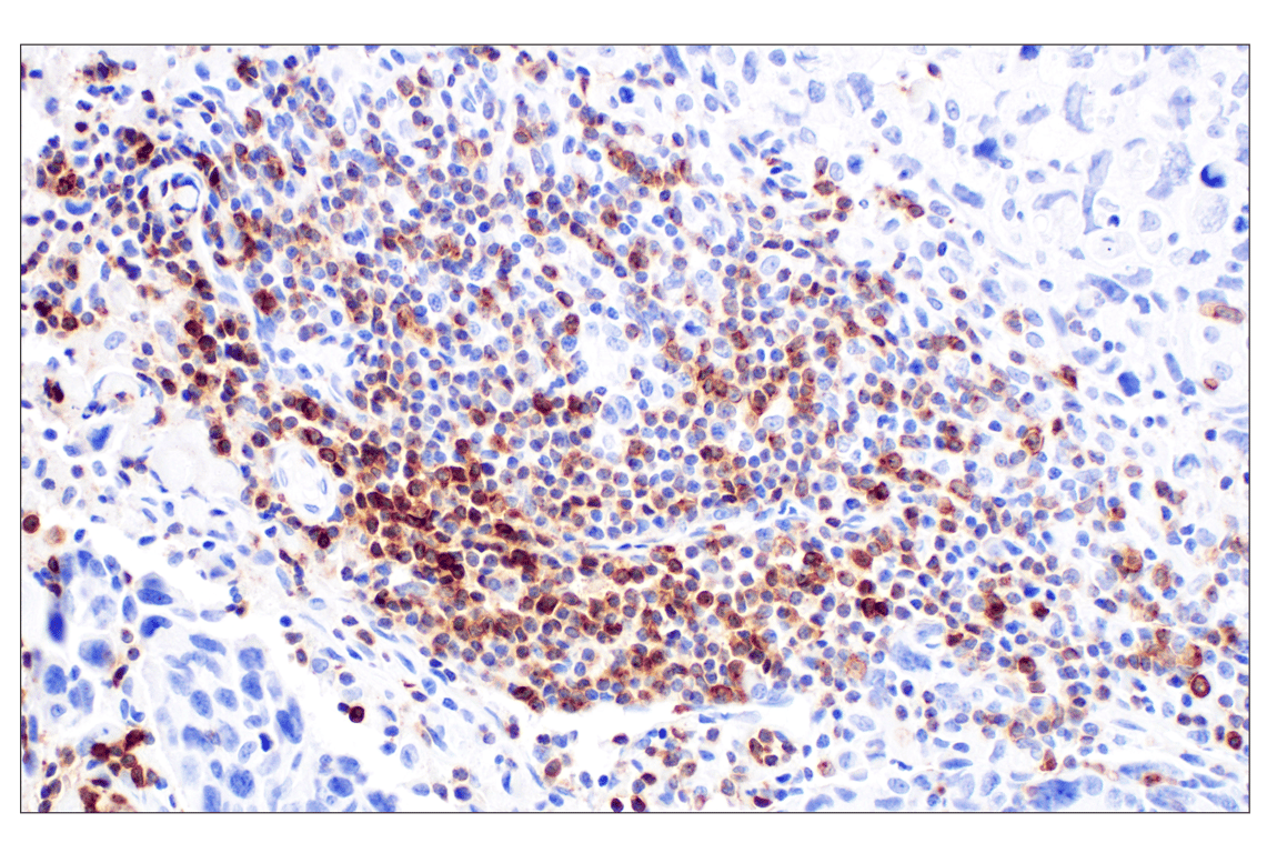 Immunohistochemistry Image 3: CCR4 (F9A9K) Rabbit Monoclonal Antibody