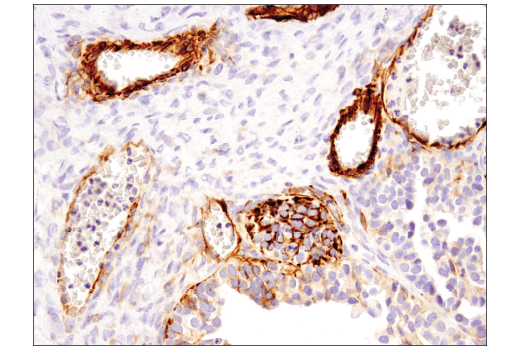 Immunohistochemistry Image 5: Nestin (10C2) Mouse Monoclonal Antibody