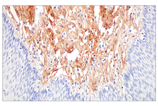 Immunohistochemistry Image 8: COL14A1 (E5W8S) Rabbit Monoclonal Antibody (BSA and Azide Free)