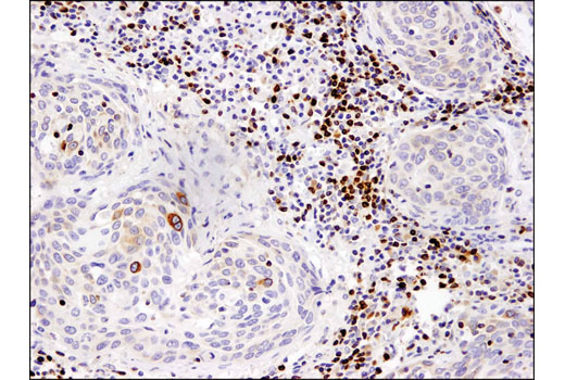 Immunohistochemistry Image 2: Bcl-2 (124) Mouse mAb (BSA and Azide Free)