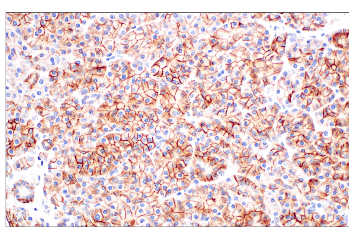 Immunohistochemistry Image 8: TACSTD2/TROP2 (F4W4J) Rabbit Monoclonal Antibody