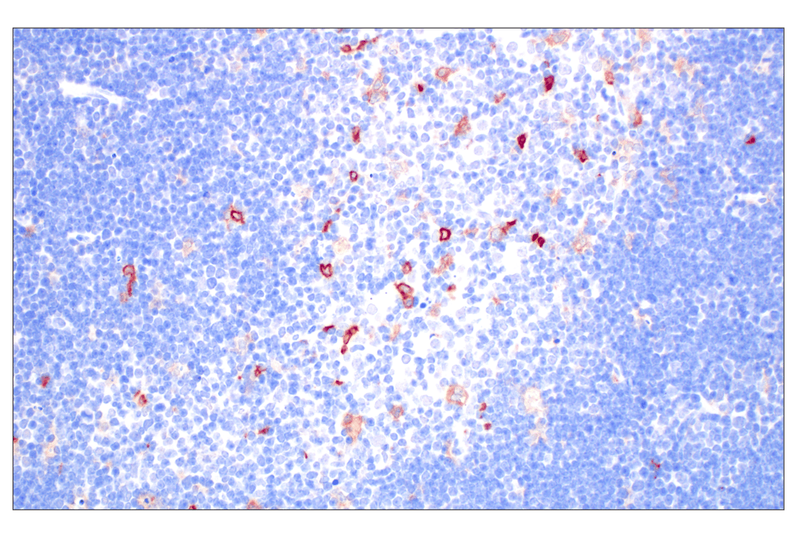 Immunohistochemistry Image 4: DAP12 (F1Q2P) Rabbit Monoclonal Antibody