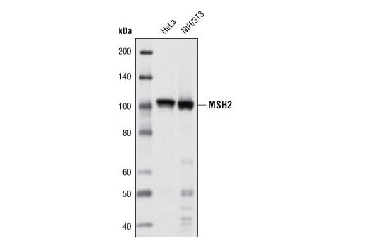 undefined Image 1: Mismatch DNA Repair (MMR) Antibody Sampler Kit