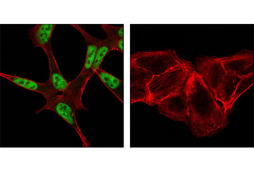 Immunofluorescence Image 1: Androgen Receptor (D6F11) Rabbit Monoclonal Antibody