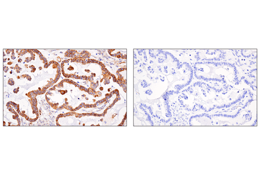 Immunohistochemistry Image 4: APP (E3F3P) Rabbit Monoclonal Antibody (BSA and Azide Free)