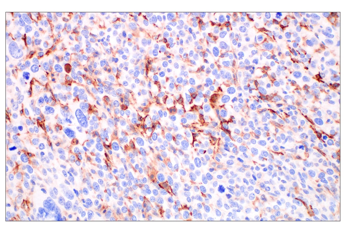 Immunohistochemistry Image 3: LYVE-1 (E5P8S) Rabbit Monoclonal Antibody