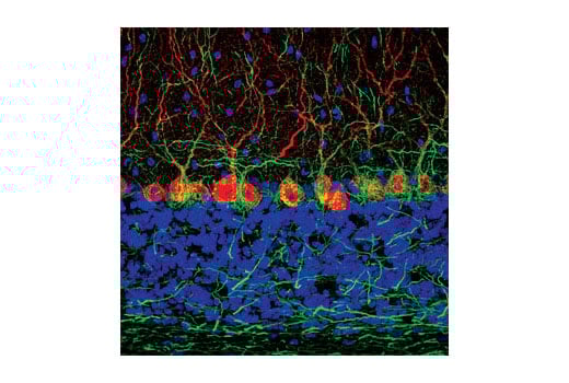 Immunofluorescence Image 1: Neurofilament-H (RMdO 20) Mouse Monoclonal Antibody